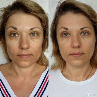 Массаж лица и тела гуаша  - купить на сайте объявлений Севастополь онлайн