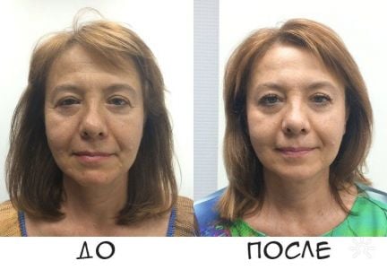 Скульптурный массаж лица  - купить на сайте объявлений Севастополь онлайн